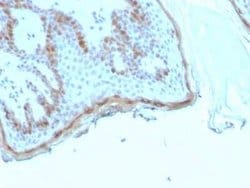 Filaggrin Mouse anti-Human, Clone: rFLG/1945, Novus Biologicals 20 &mu;g | Buy Online | Novus Biologicals | Fisher Scientific